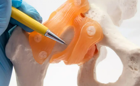 طلاء جديد لزراعة العظام